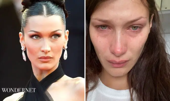 Bella Hadid Rivela: «Soffro Di Ansia E Depressione» - Wondernet Magazine